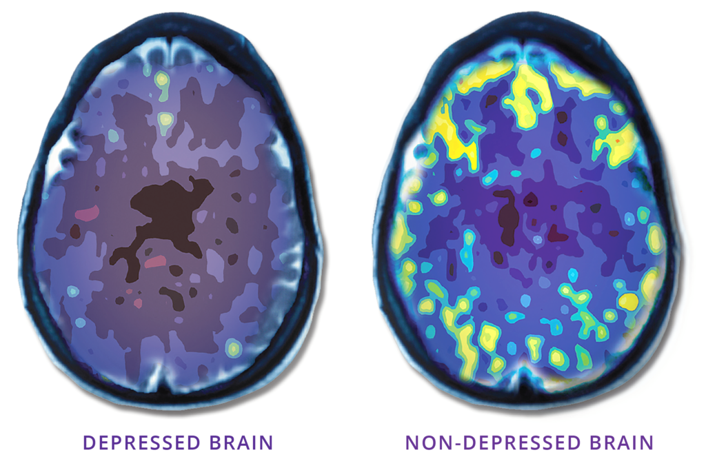 Brain scan comparison